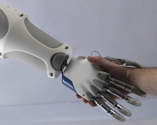 bionická ruka