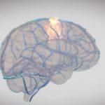 Synchron, konkurent Neuralinku, chce mozgovým implantátom liečiť Parkinsona